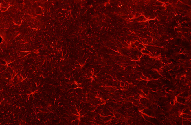 glia-cells.jpg