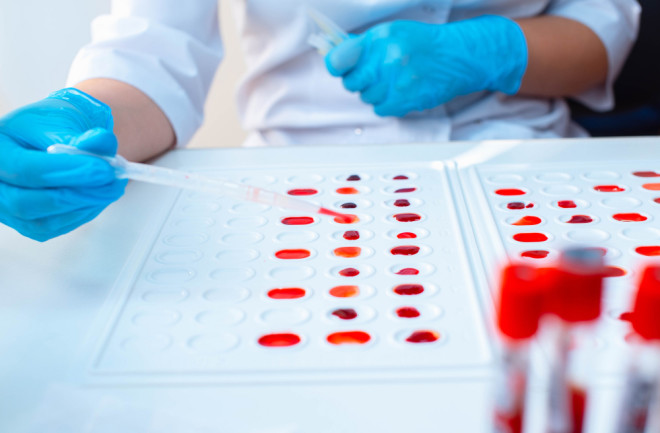 blood type testing lab