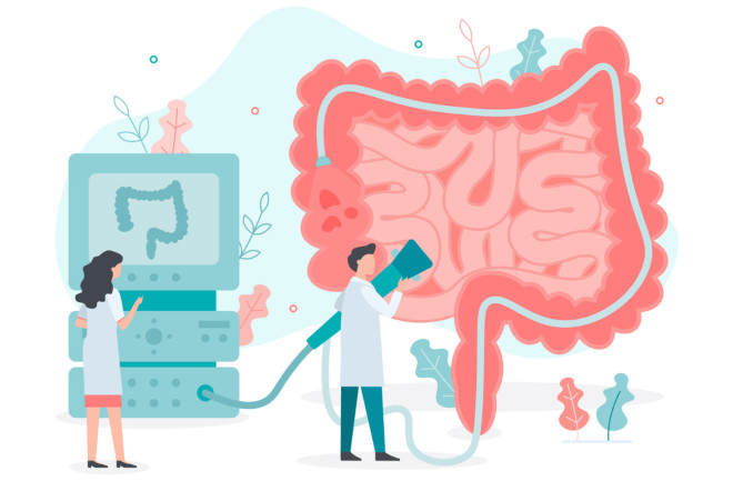 Colon cancer screening